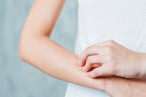 Vitamin B6 Deficiency, Symptoms and Signs in adults a girl feeling itchy and rashes
