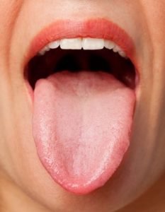 Vitamin B6 Deficiency, Symptoms and Signs in adults sore and reddish tongue